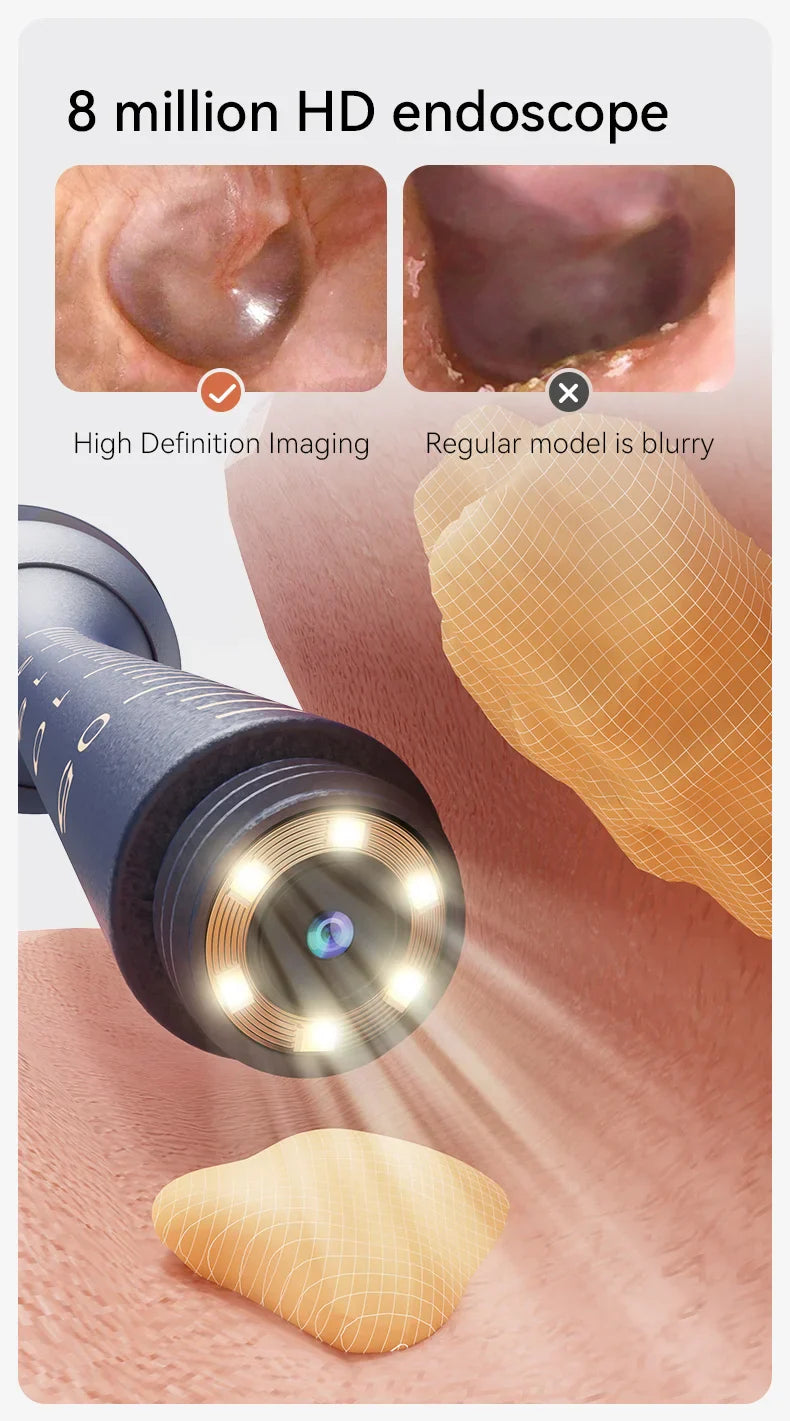 Ear Cleaning Camera - 14 Tools Kit