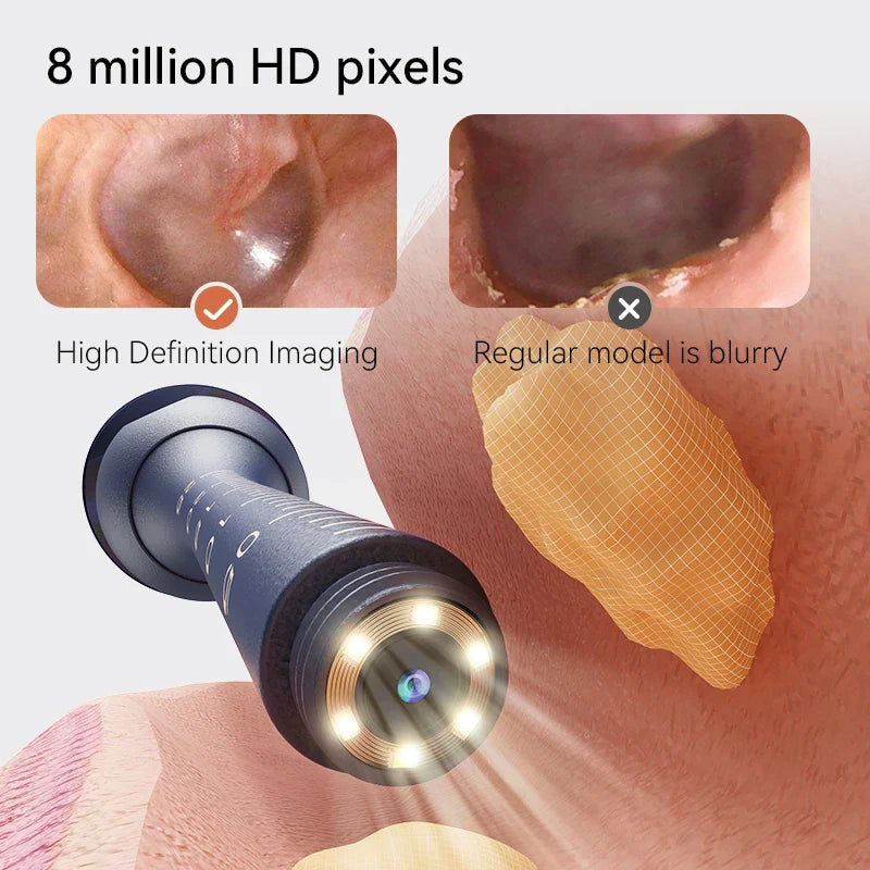 Ear Cleaning Camera - 14 Tools Kit